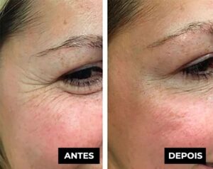 Placenta Glow – Cápsulas Rejuvenescedoras