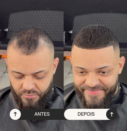 ReviveHair 30- Recupere o seu cabelo em 30 minutos!