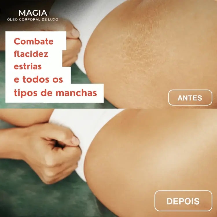 Óleo Corporal Magic™ - 100 ml
