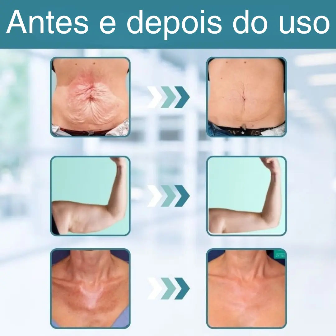 GlowEssence™ | Firma a pele flácida em 98% em apenas 24 horas!
