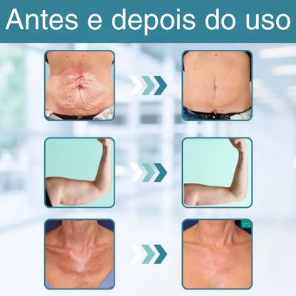 GlowEssence™ | Firma a pele flácida em 98% em apenas 24 horas!