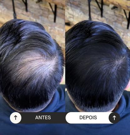 ReviveHair 30- Recupere o seu cabelo em 30 minutos!