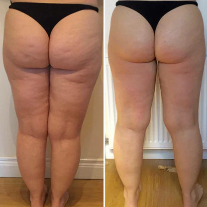 CelluFree 4D