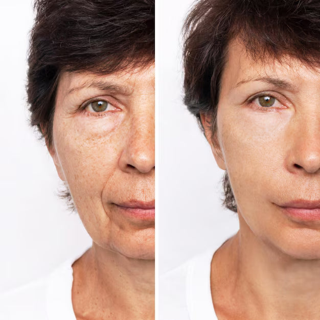 Creme Lifting Firmador Remover Rugas em 60 segundos