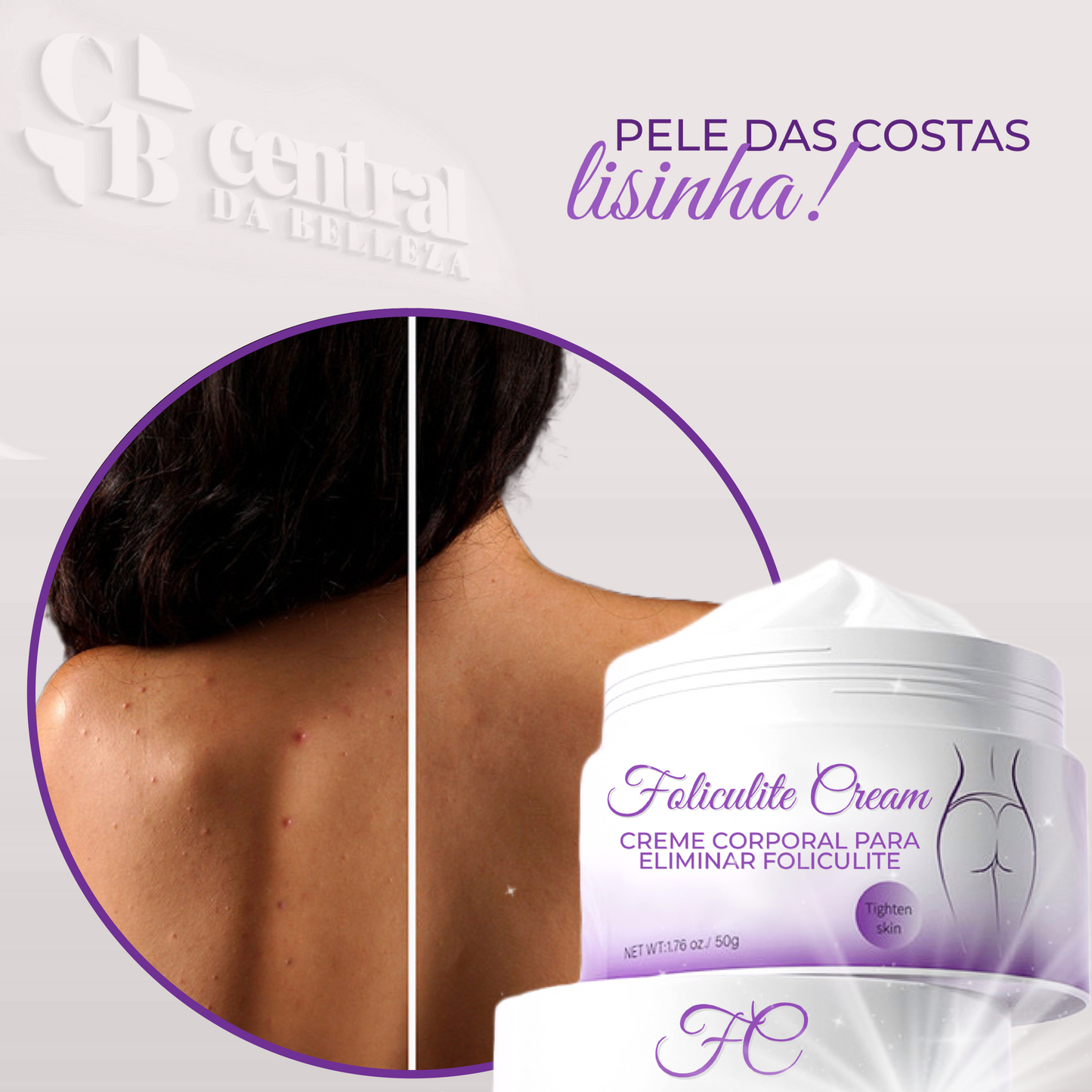 Folicure Cream - Creme Corporal para Foliculite