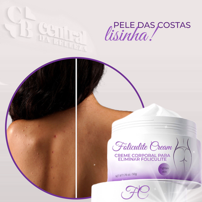 Folicure Cream - Creme Corporal para Foliculite